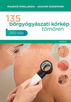 Kép: 135 bőrgyógyászati kórkép tömören