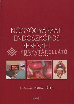 Kép: Nőgyógyászati endoszkópos sebészet