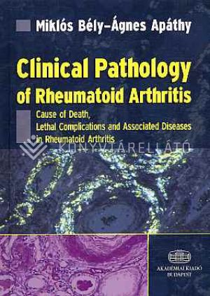 Kép: Clinical Pathology of Rheumatoid Arthritis