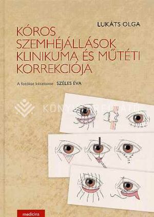 Kép: Kóros szemhéjállások klinikuma és műtét