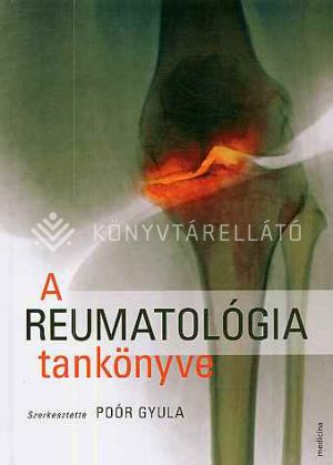 Kép: A reumatológia tankönyve