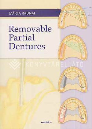 Kép: Removable partial dentures